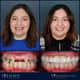 Slider image (9) Soho Dental Clinic – All-on-X & Dental Implant Center